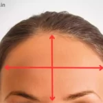 How To Make your forehead smaller permanently